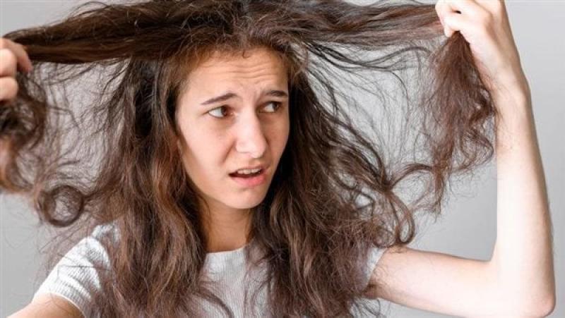 دراسة: تساقط الشعر يسبب اضطرابات نفسية وعزلة اجتماعية