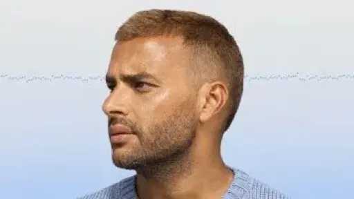 الفن