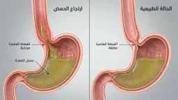 الأسرة والمجتمع