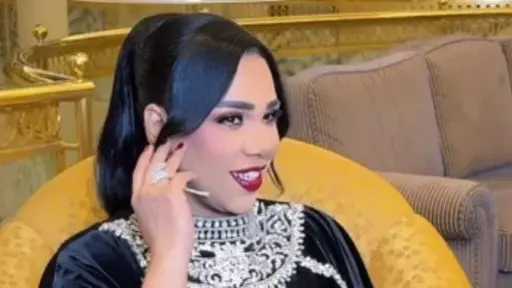 الفن